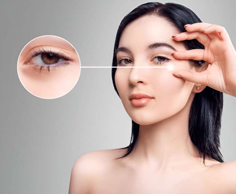 before and after dermal fillers under eyes