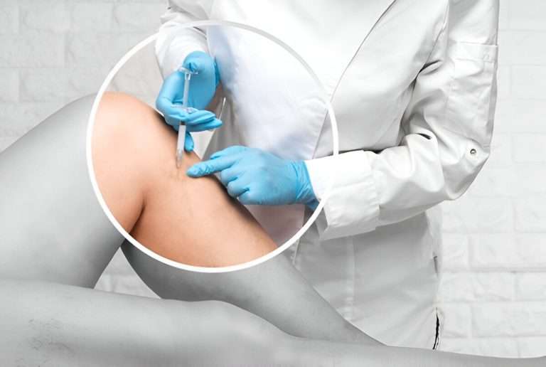 what is sclerotherapy
