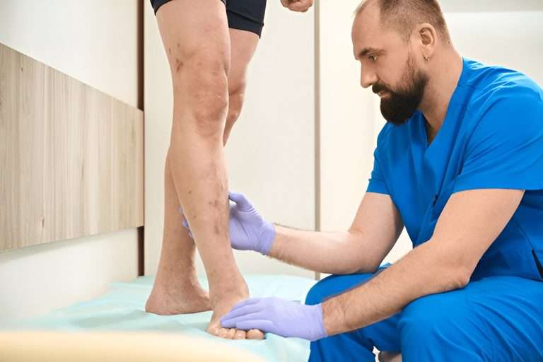 spider vein treatment