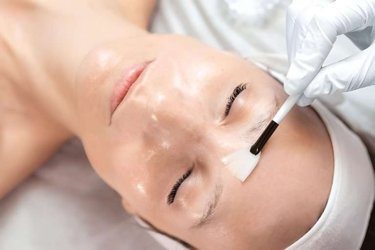 microneedling vs chemical peel