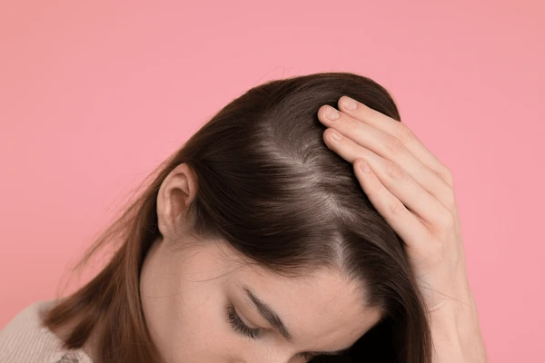 hair thinning